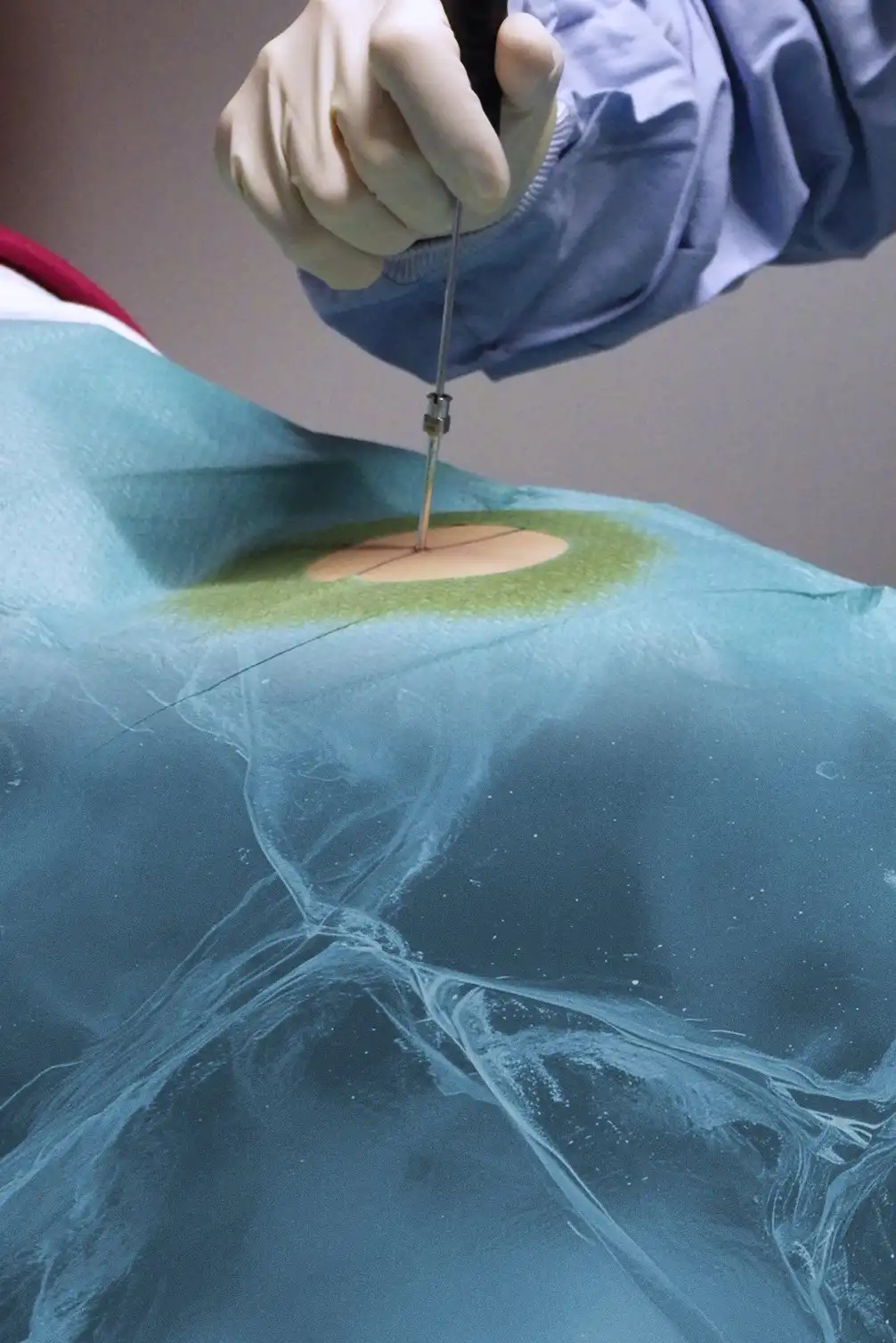 Einfache und sichere Platzierung